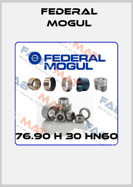 76.90 H 30 HN60       Federal Mogul